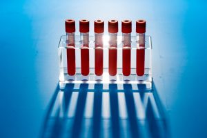 tubes of blood ready for testing